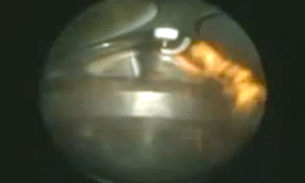 Video: Verbrennungsmotor bei der Arbeit